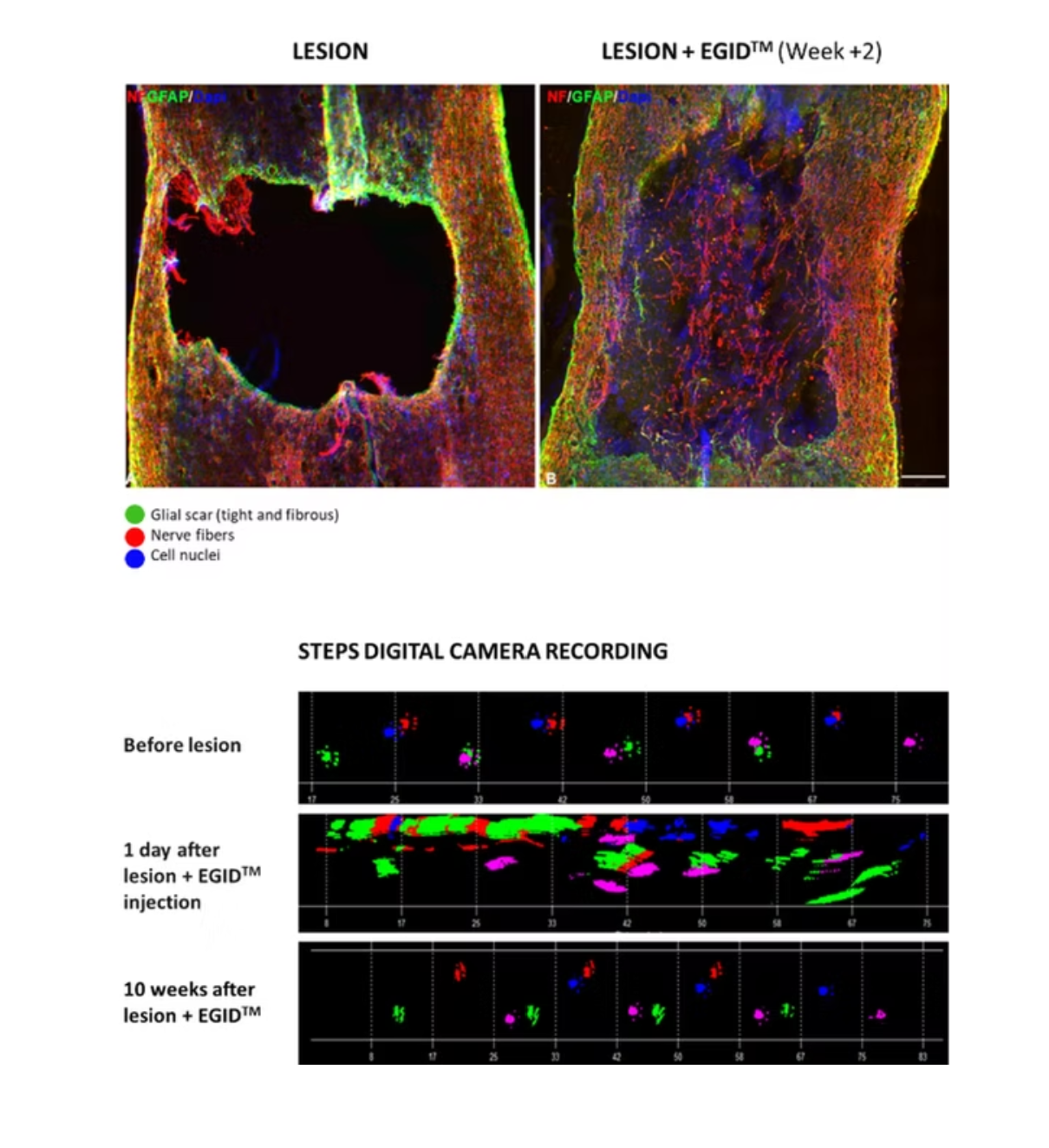 Home Imaging Medjeduse - Nerve lesion repair